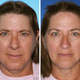 Image for article titled Guess which of these identical twins is the smoker
